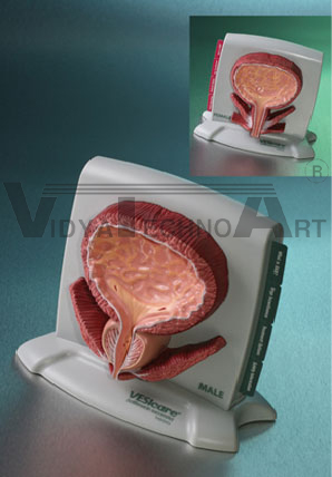 Male/Female Bladder Model